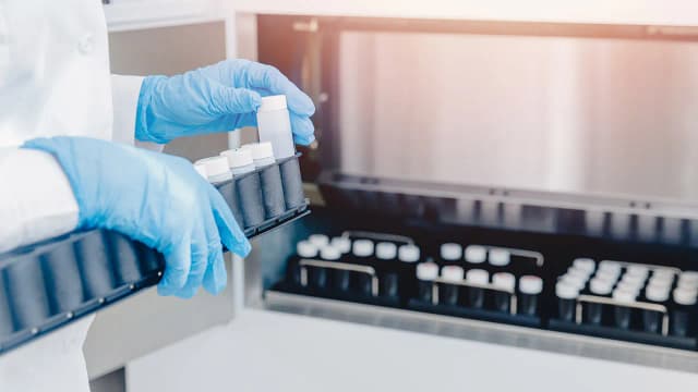 Ile można zarobić jako dawca spermy? Fakty i mity o wynagrodzeniu